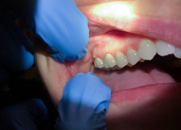  Deville, AL Emergency Dentist Pros