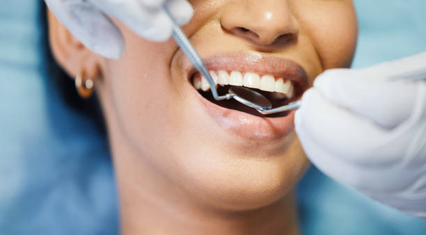 Best Emergency Root Canal Treatment in Deville, AL