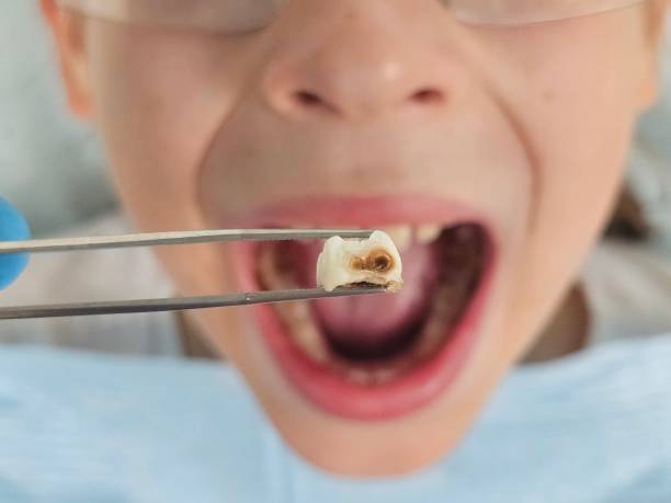 Best Emergency Dental Services for Seniors in Deville, AL